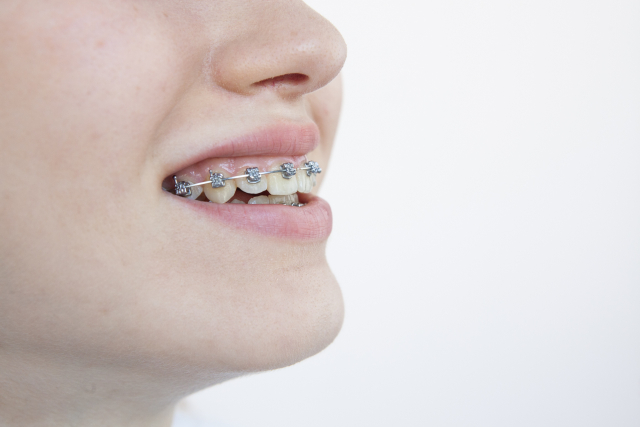 信頼できる歯医者は、何を基準に選べば良いのか？