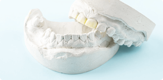 歯並びの原因